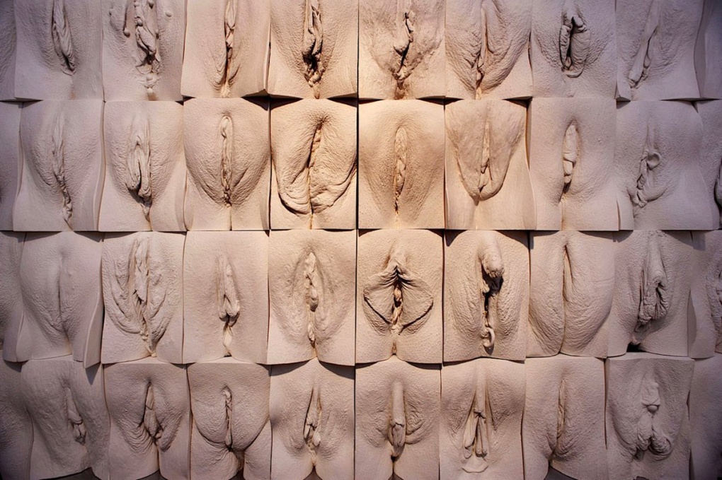 Необычное расположение вагины