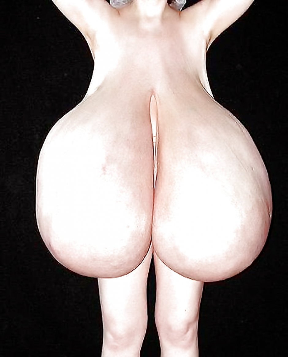 Макромастия гигантомастия