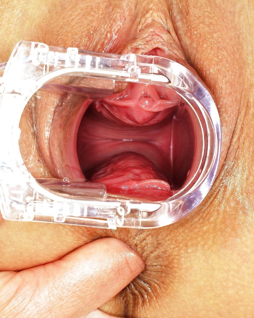 Здоровое влагалище внутри