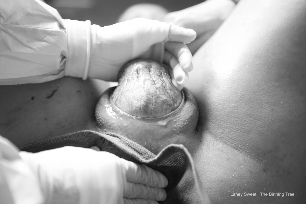 Childbirth close up крупный плод