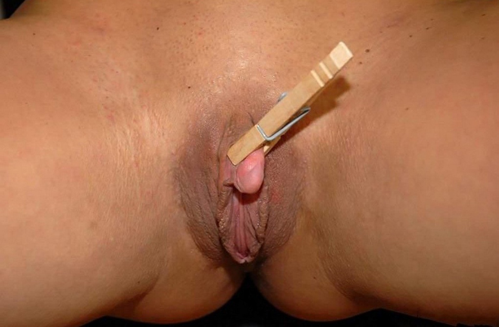 Перевязывание клитора