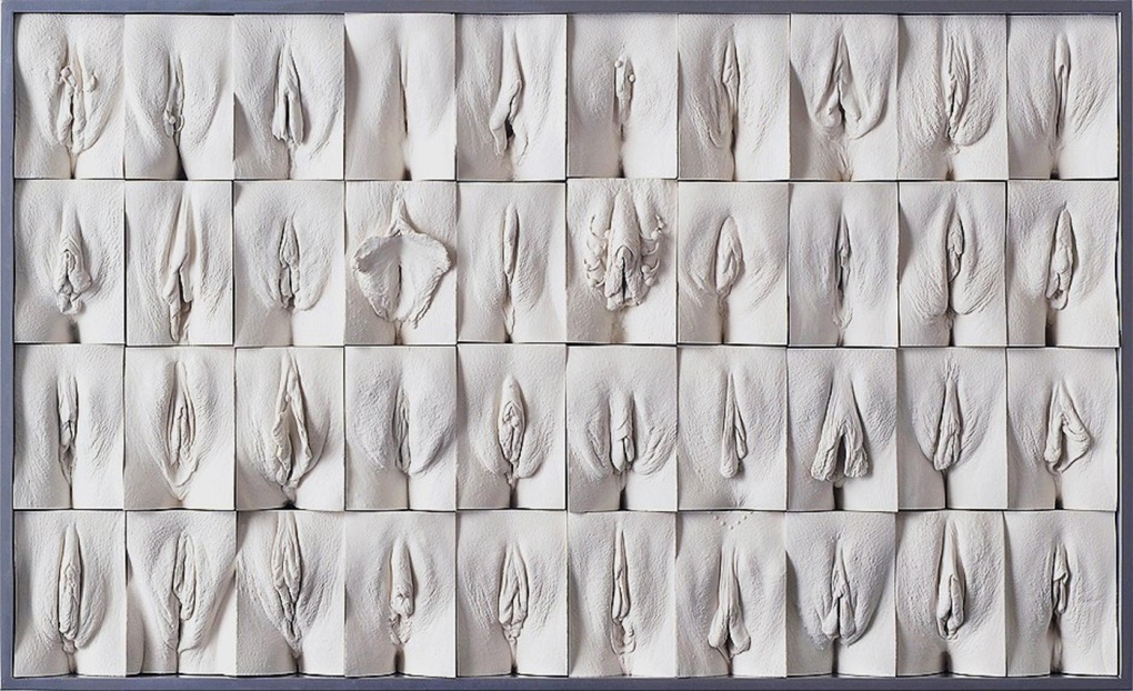 Необычное расположение вагины