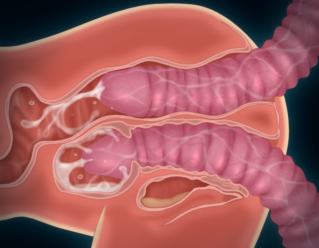 Анальный половой акт в разрезе