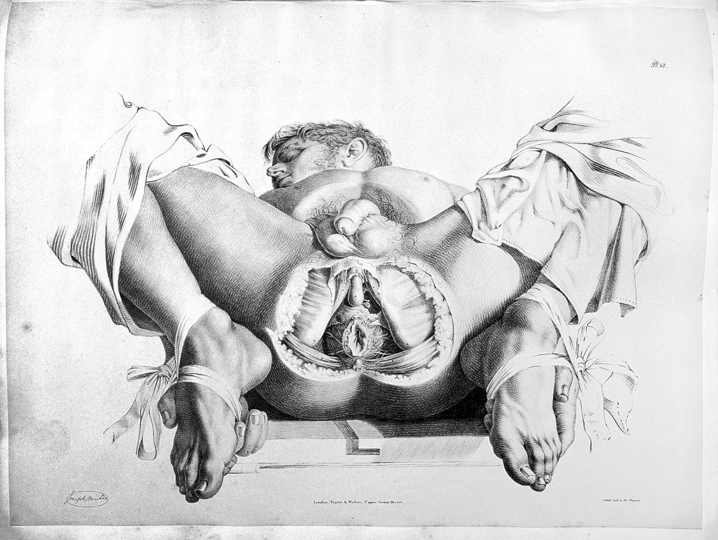 Картины с изображением гениталий