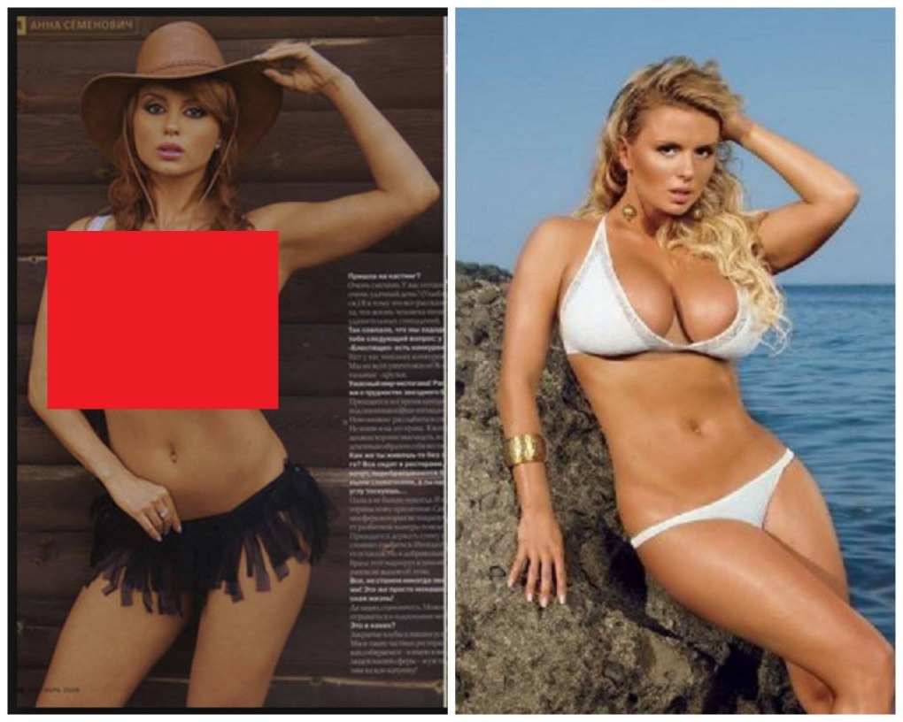 Анна Семенович до пластики