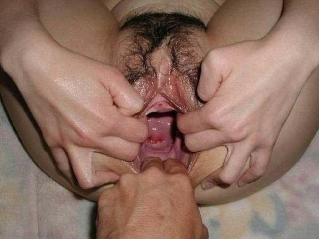 Расширитель влагалища у гинеколога