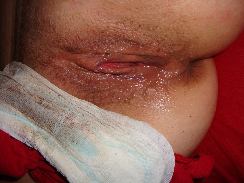 Вагина panties менструация