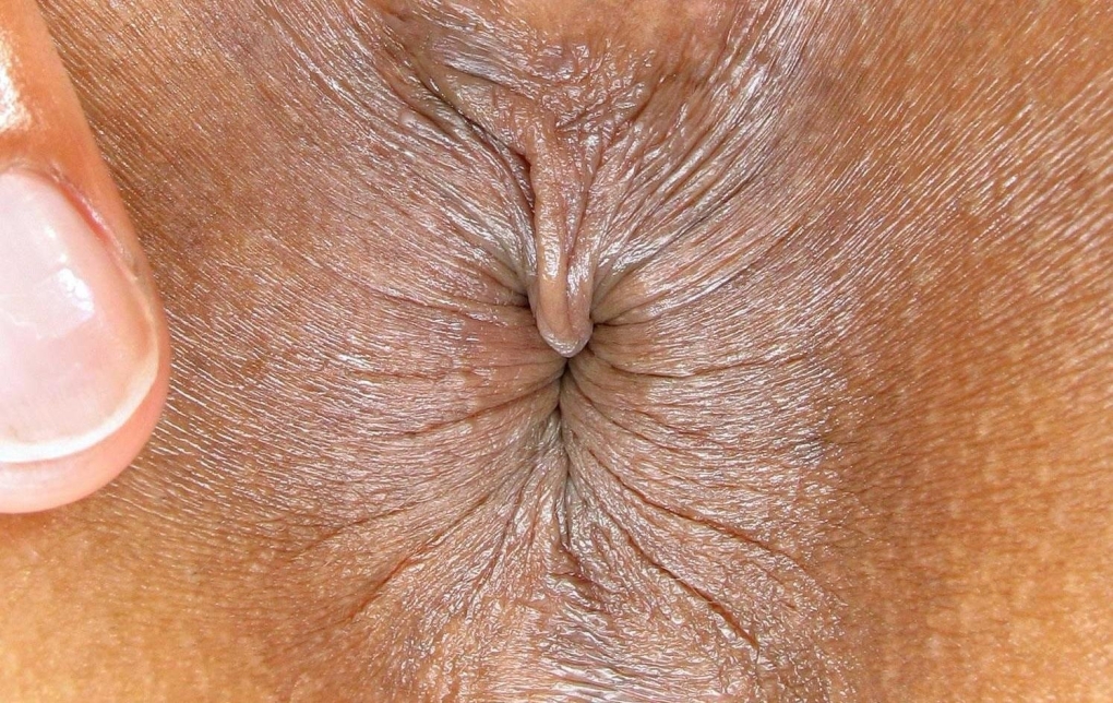 Красивый коричневый анус