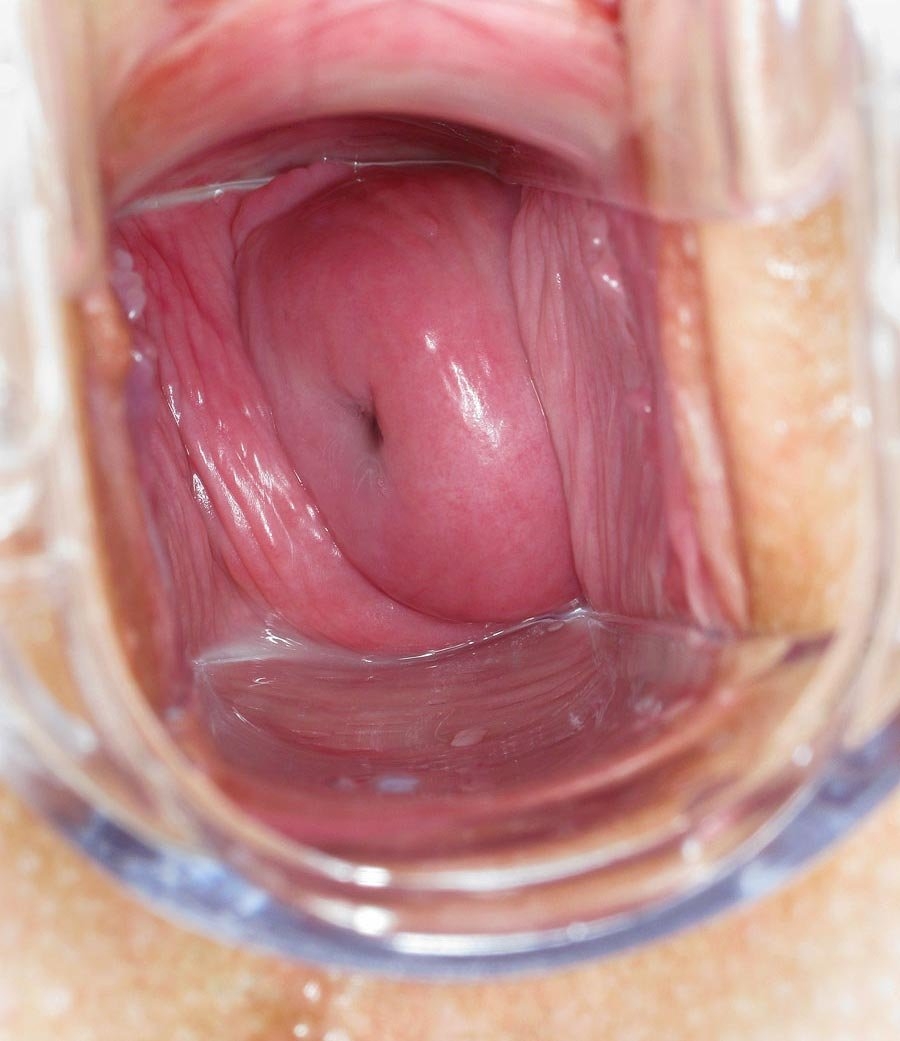 Строение вагины изнутри