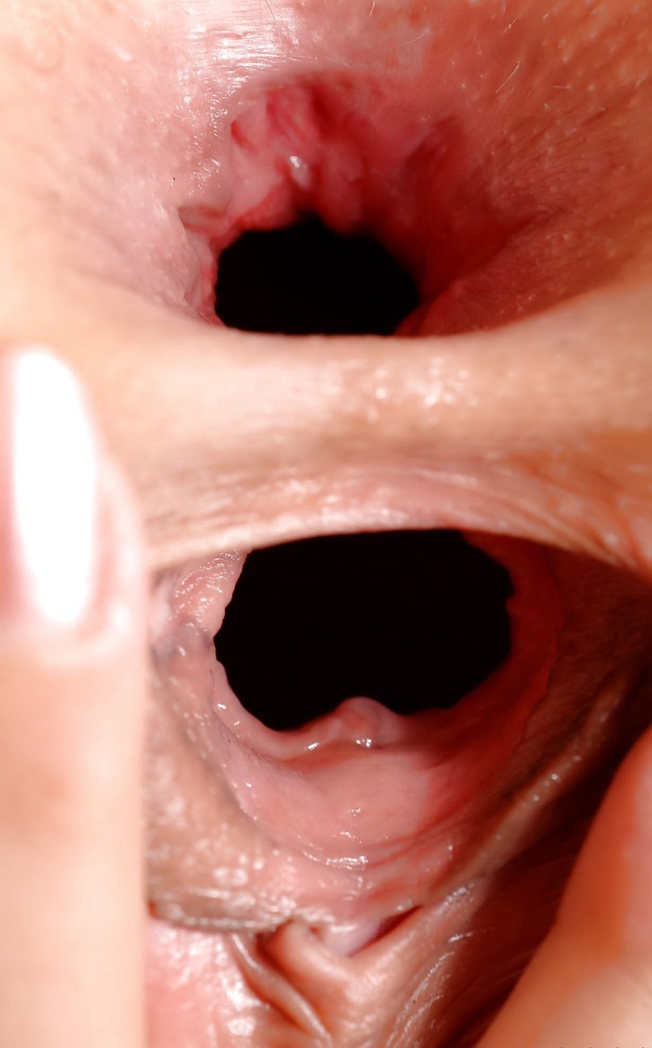 Вагина вывернутая наизнанку