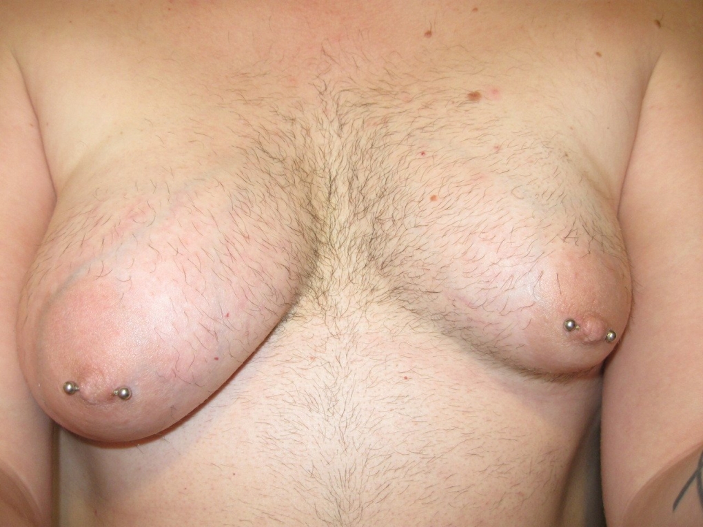 Волосатые сиськи у женщин