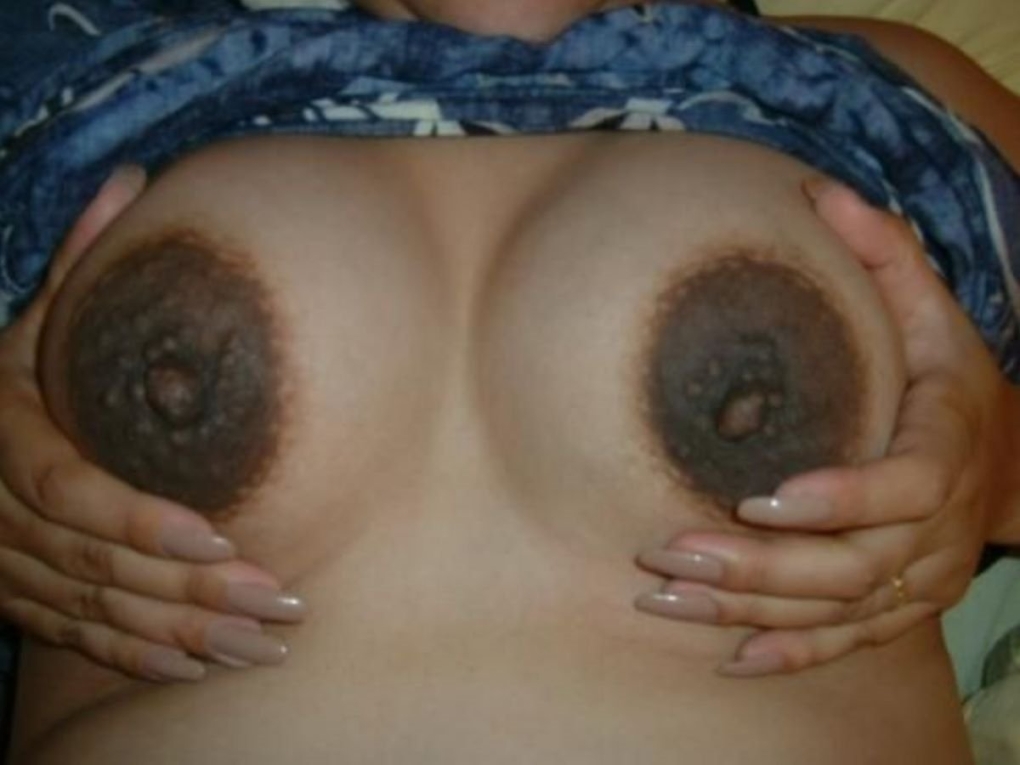 Большие темные ореолы сосков