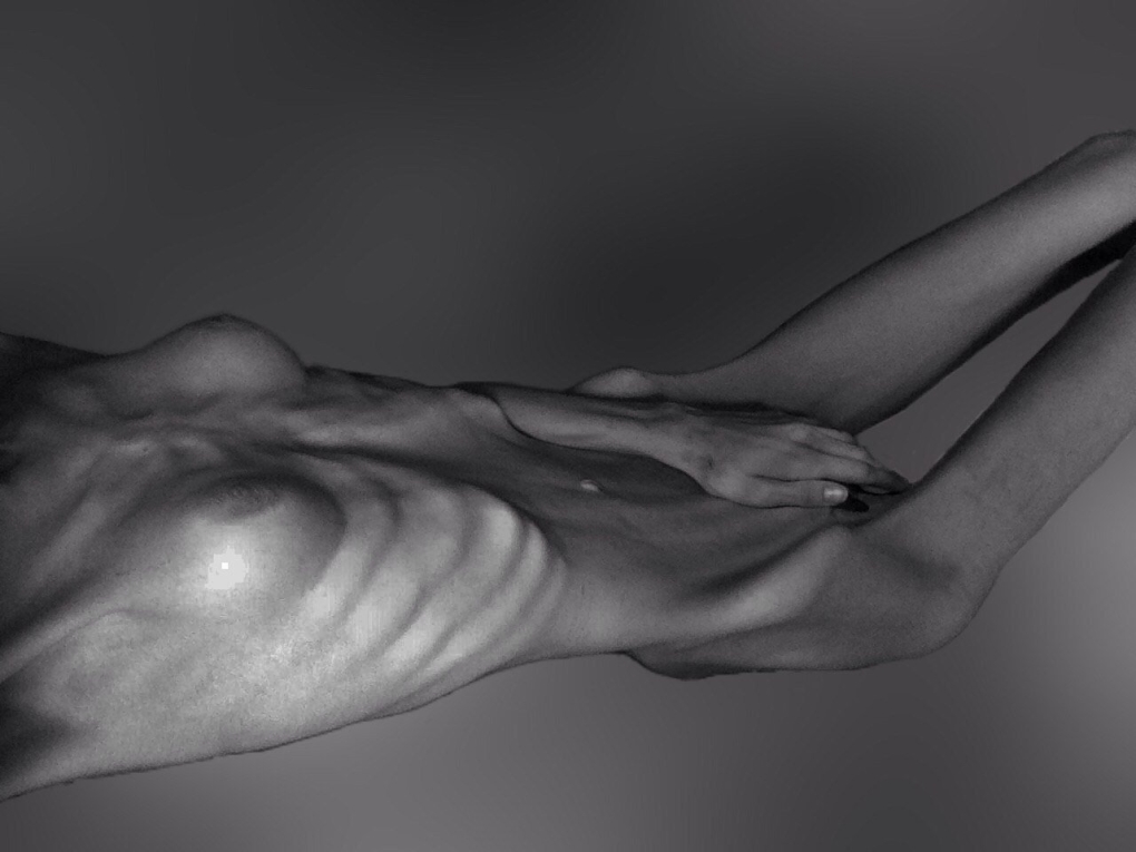 Атлетическая анорексия