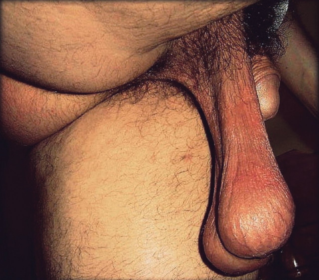 Самые большие мужские яйца