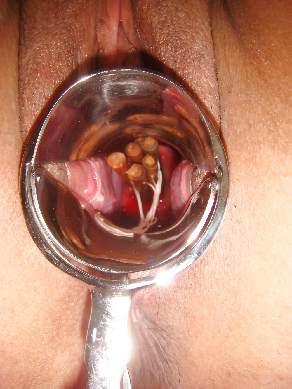 Красивая девушка с расширителем влагалища