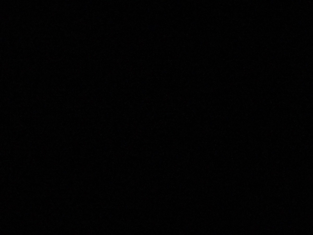 Катетер уретральный