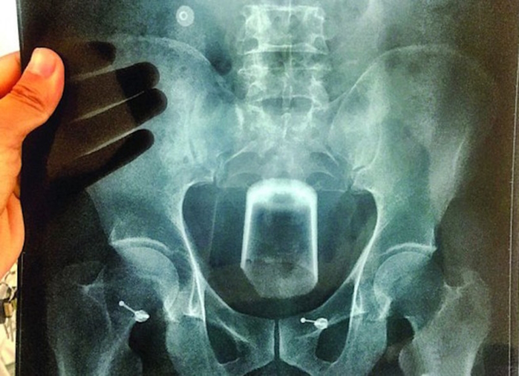 Стикер кот с членом