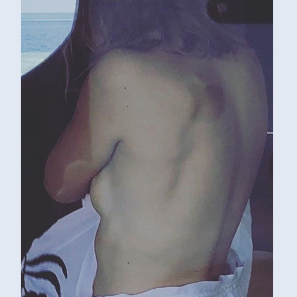 Интимные снимки