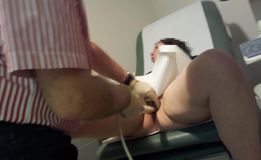 Голые женщины на медосмотре