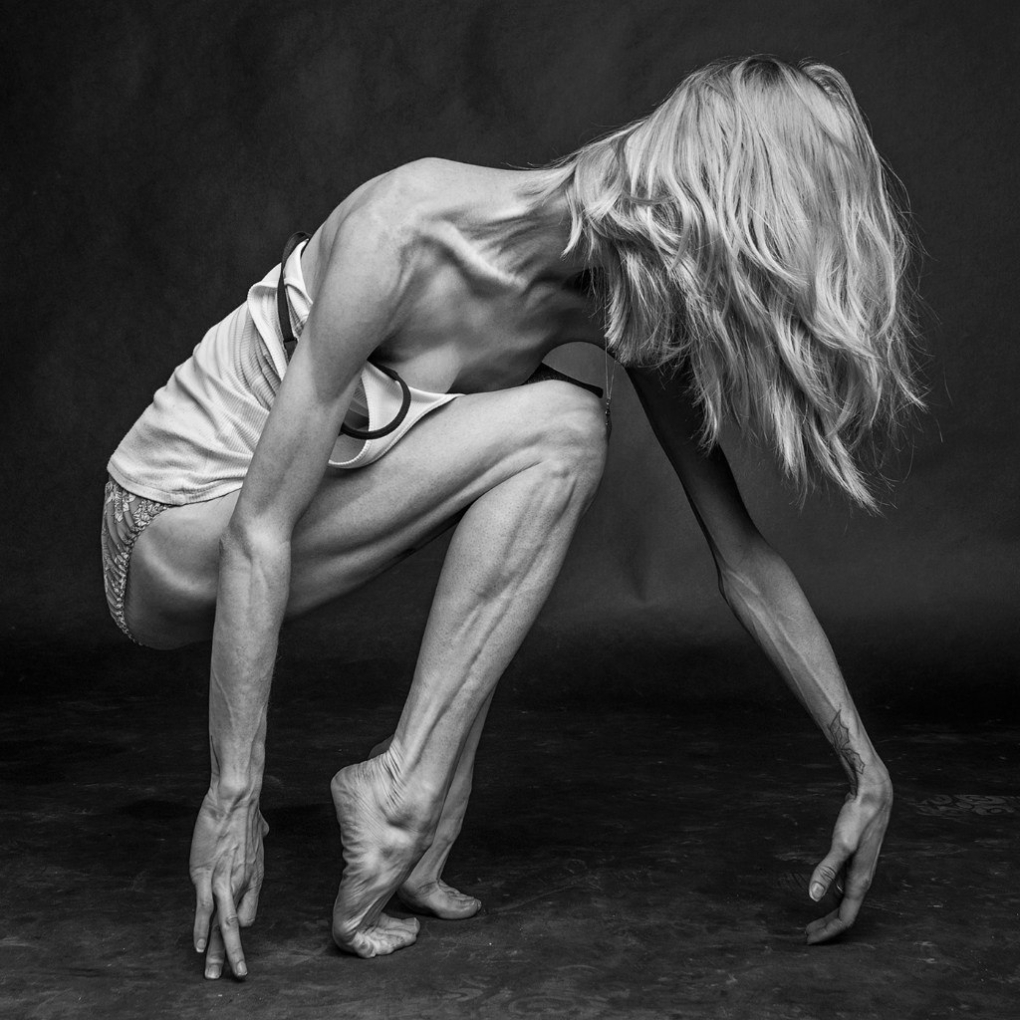 Гениталии Анорексички