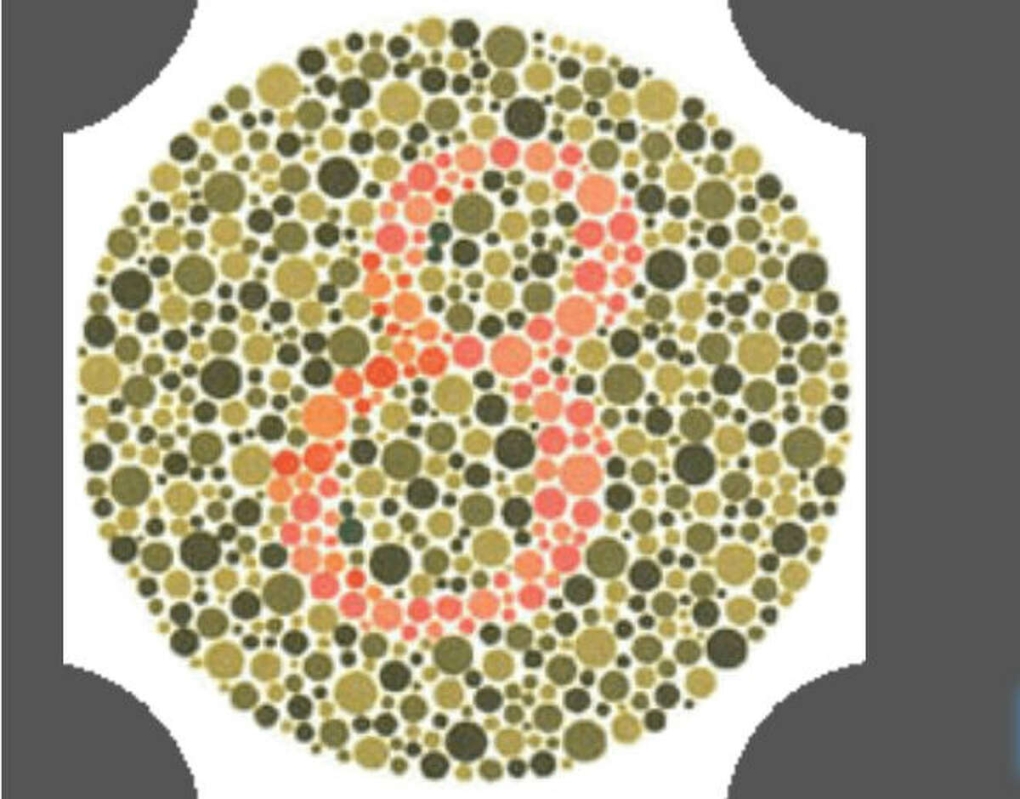 Веселый прием у окулиста