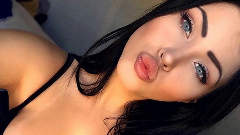 Клаудия Альенде до пластики